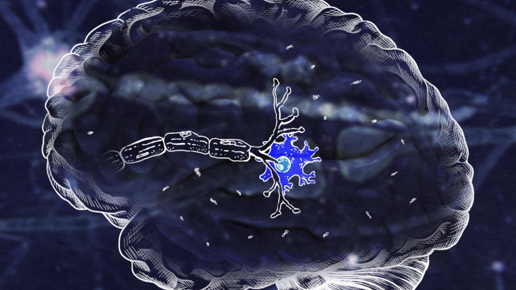 삼성전자, ‘세계 알츠하이머의 날’ 맞아 연구원들의 노력을 담은 영상 공개